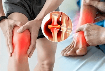 Schéma pro aplikaci gelu Icexin na oblast kolenního kloubu a chodidla